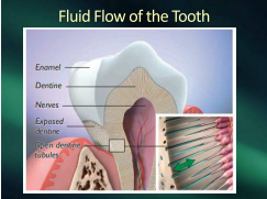 fluid flow in tooth
