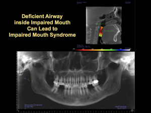 deficient airway