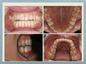 clincial dental photos