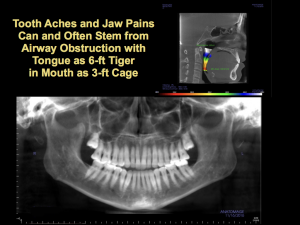 airway obstruction