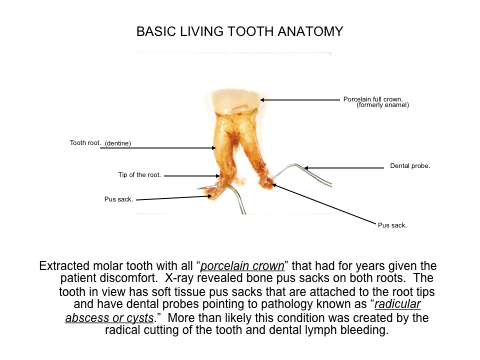 tooth anatomy
