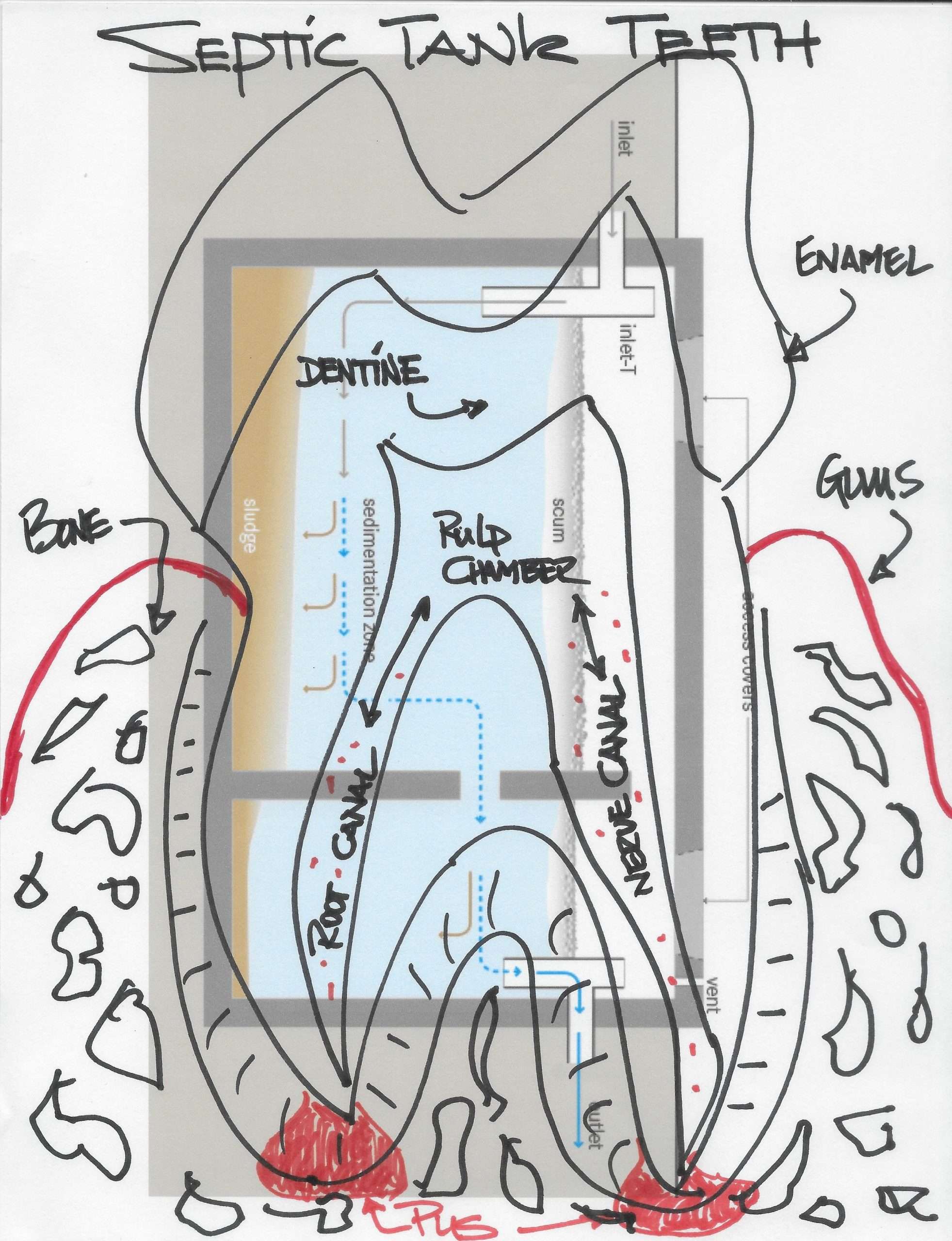 tooth diagrammed over septic tank
