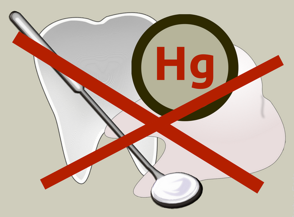 red x through mercury amalgam