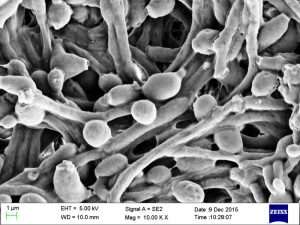 Candida albicans under electron microscope