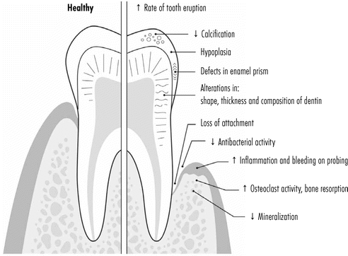 dental effects of vitamin D deficiency