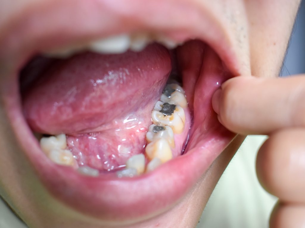 Biological Dentistry