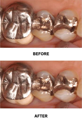 Mercury Is Considered A Hazardous Material